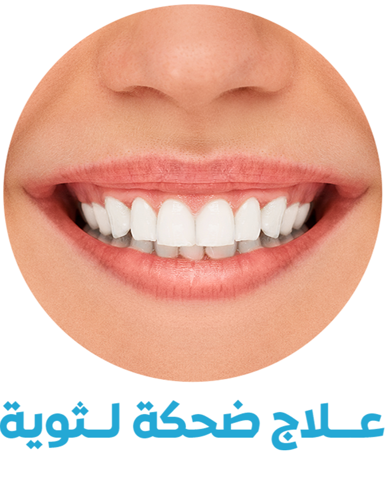 علاج الضحكة اللثوية